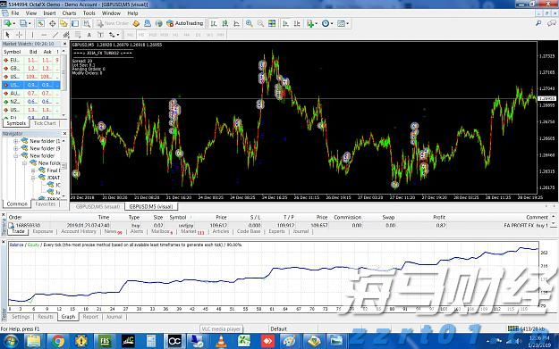 医我看丨跨境医疗很方便！香港七旬长者北上在珠海成功换膝